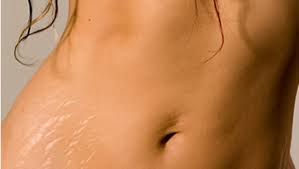 How To Fade Scars & Stretch Marks Naturally