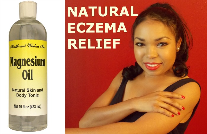 Natural Relief For Eczema Ms Toi 